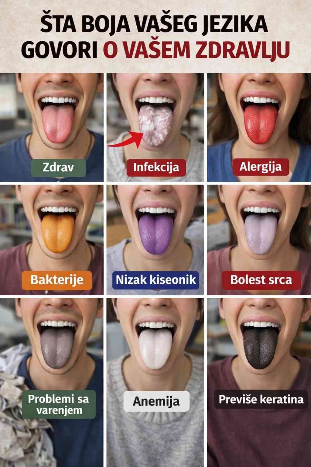 Šta boja vašeg jezika govori o vašem zdravlju | 9 znakova upozorenja koje nikada ne biste trebali ignorisati