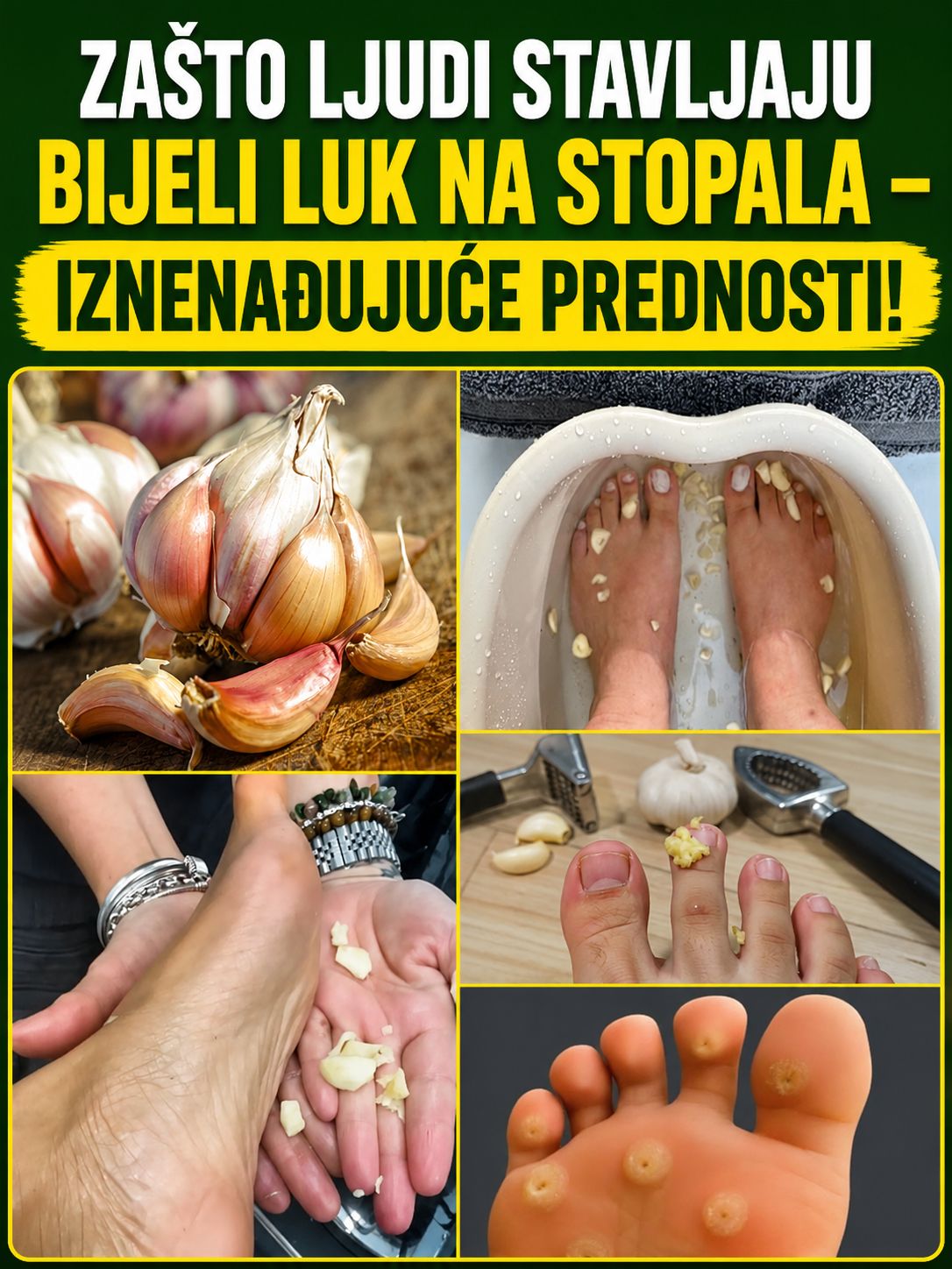 Izvanredna moć bijelog luka za zdravlje stopala: Prednosti i domaća upotreba